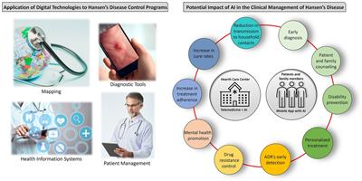The potential role of artificial intelligence in the clinical management of Hansen’s disease (leprosy)